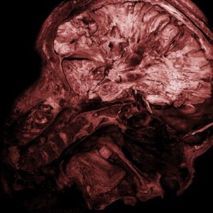 THANATOPSIS - Stages of Decomposition