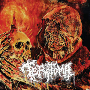 TERATOMA -  Purulent Manifestations