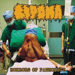 LIPOMA - Horrors of Pathology